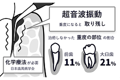 【技術詳解】ブルーラジカルP-01がもたらす「殺菌」のメカニズム