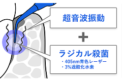 1.光と過酸化水素の化学反応(ラジカル殺菌)