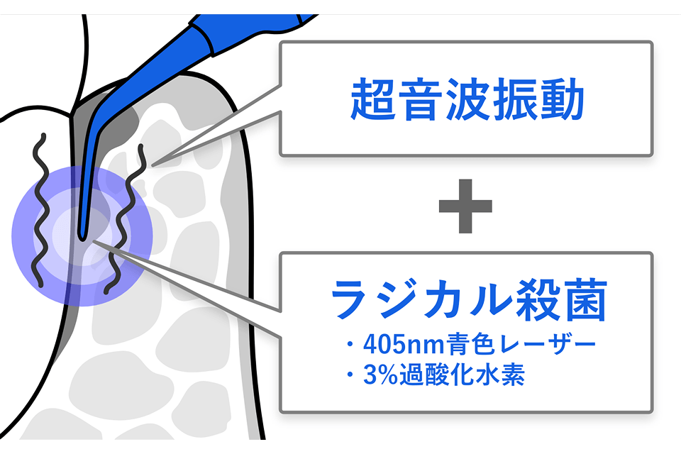 1.光と過酸化水素の化学反応(ラジカル殺菌)