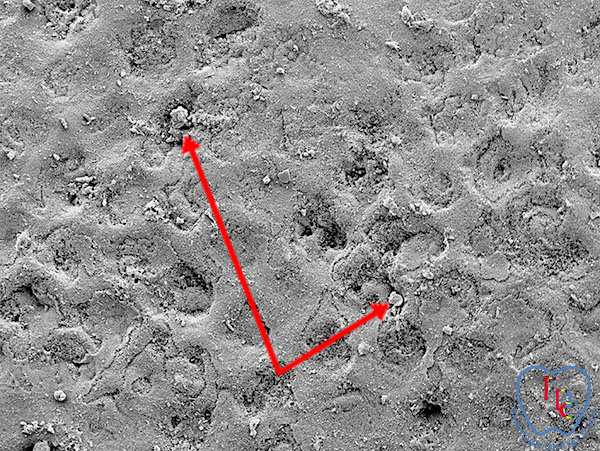歯に細菌が付いている清掃前の残存バイオフィルム